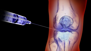 Eklem içi Enjeksiyonlar